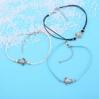 uploads/erp/collection/images/Fashion Jewelry/zuowen/XU0513022/img_b/XU0513022_img_b_3